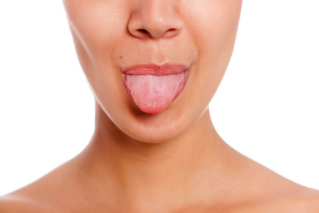 Biały nalot na języku – przyczyny, objawy, zapobieganie